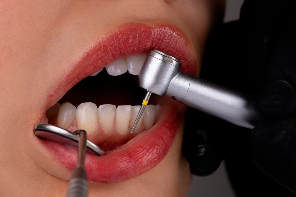 tooth scaling & root planning