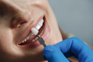 Dental Implants Cost