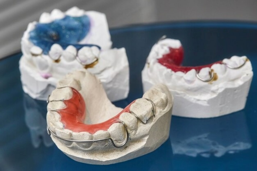 Dental Implants vs Dentures vs Bridges